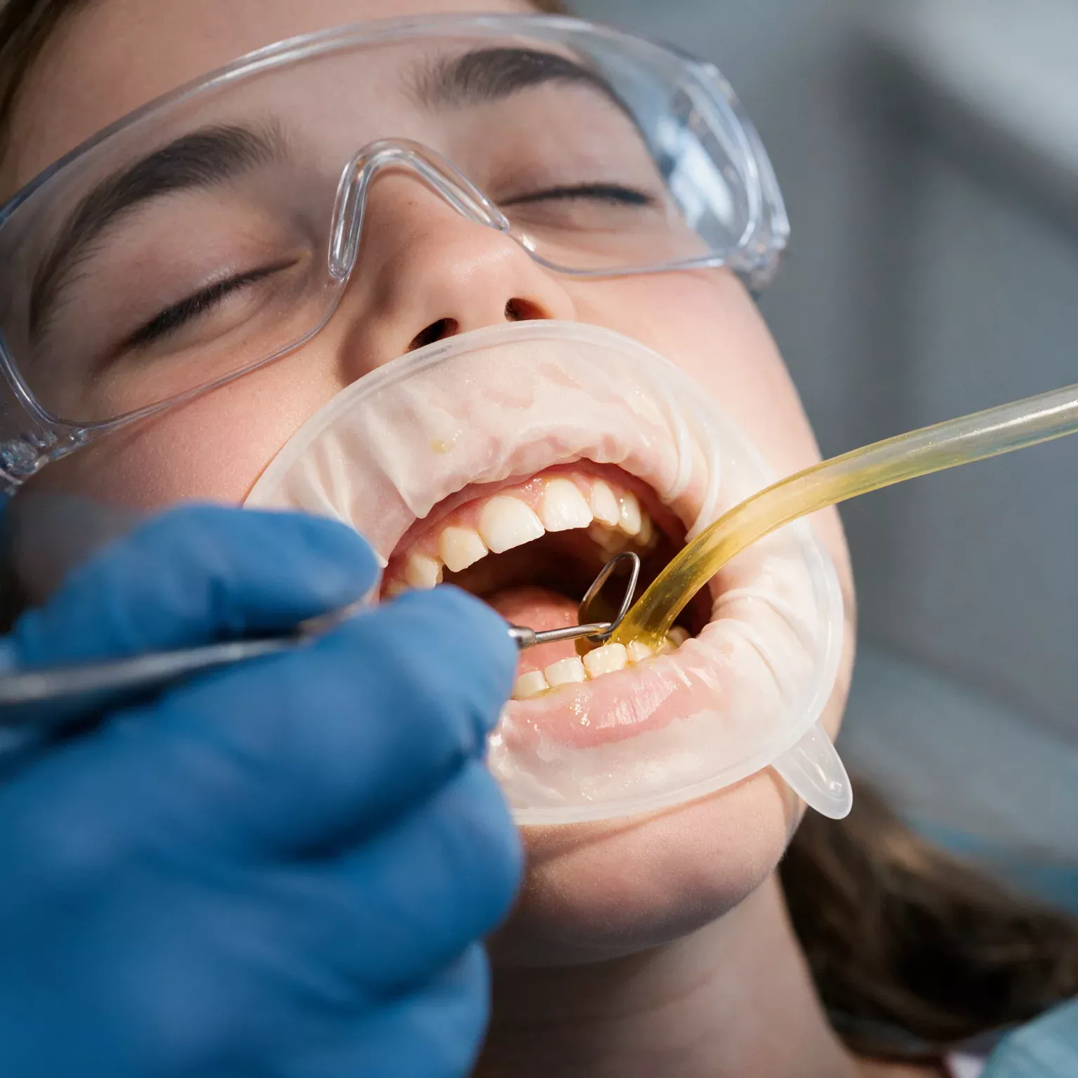 Seduta di chirurgia orale: intervento con diga dentale e campo sterile