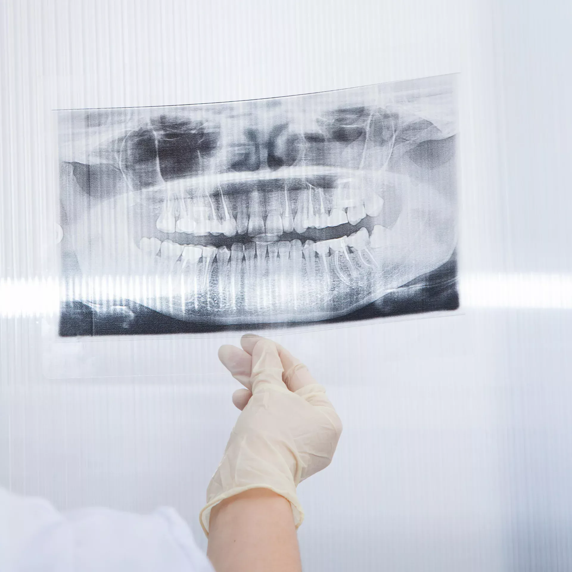 Ortopantomografia, la radiografia panoramica 2D usata per la diagnosi