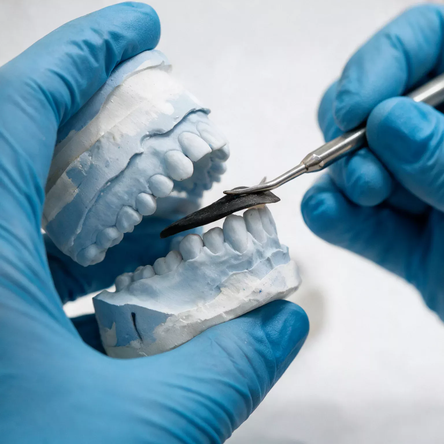 Modello in gesso dell’arcata dentale durante la preparazione di una protesi